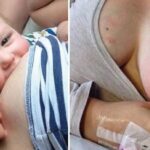 Enfermedades durante la lactancia materna