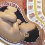 ¿Cómo me preparo para el parto?