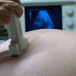 Las ecografías en el embarazo