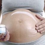 Estrías en el embarazo