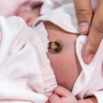 El ombligo del recién nacido: qué le pasa al cordón umbilical