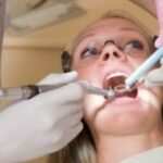 Periodontitis en el embarazo