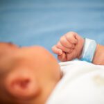 Ictericia del recién nacido